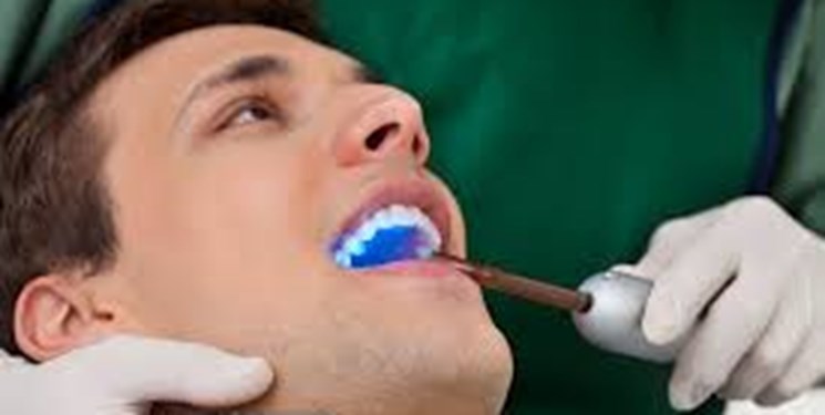 آیا مواد باندینگ دندان سرطان‌زا است؟