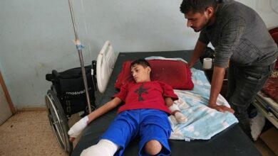 _آنروا_:_روزانه_ _پای_ _10_ _کودک_ _در_ _غزه_ _قطع_ _می_‌_شود_