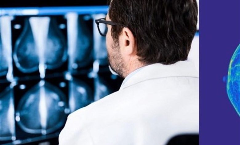 نرخ رشد 4 تا 6 درصدی سرطان پستان در ایران / اخبار فارس - اخبار استانها