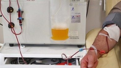 دستگاه پلاسمافِرزیس در خراسان شمالی/پایان اعزام بیماران و جهش در درمان بیماریهای حاد خونی / اخبار خراسان شمالی - اخبار استانها